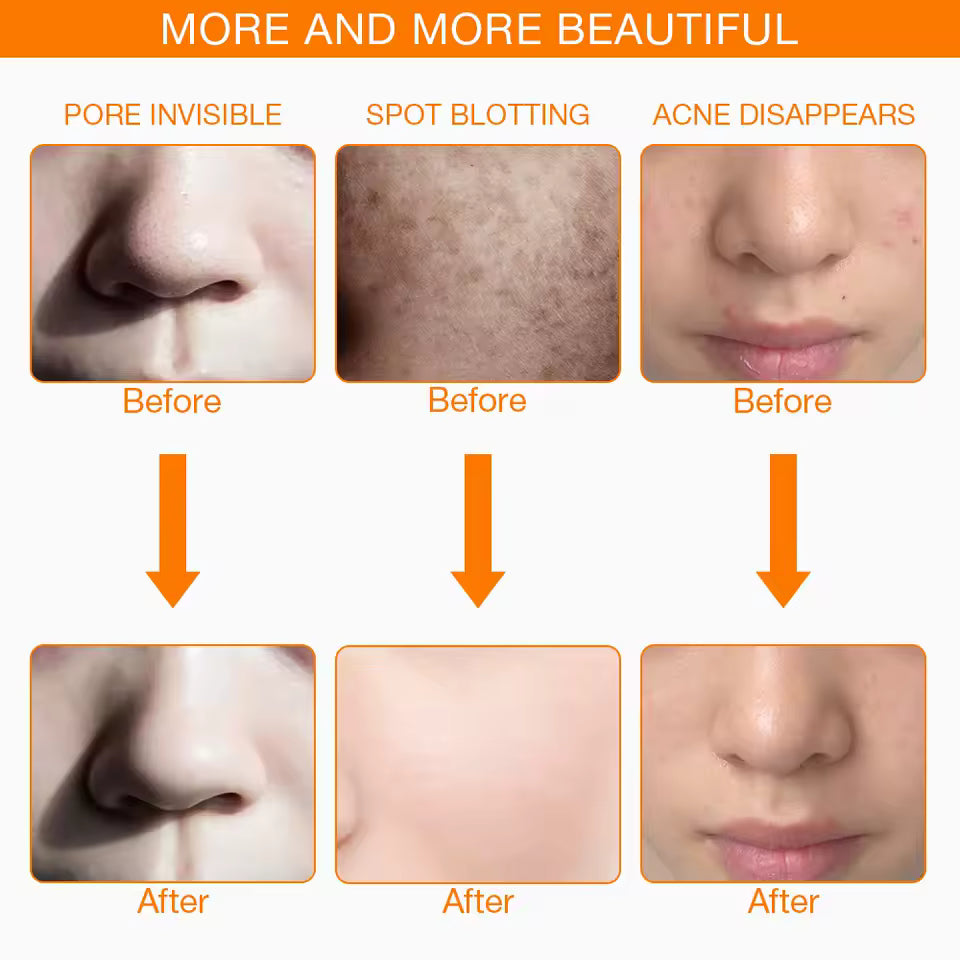 LED face & neck Beauty Mask